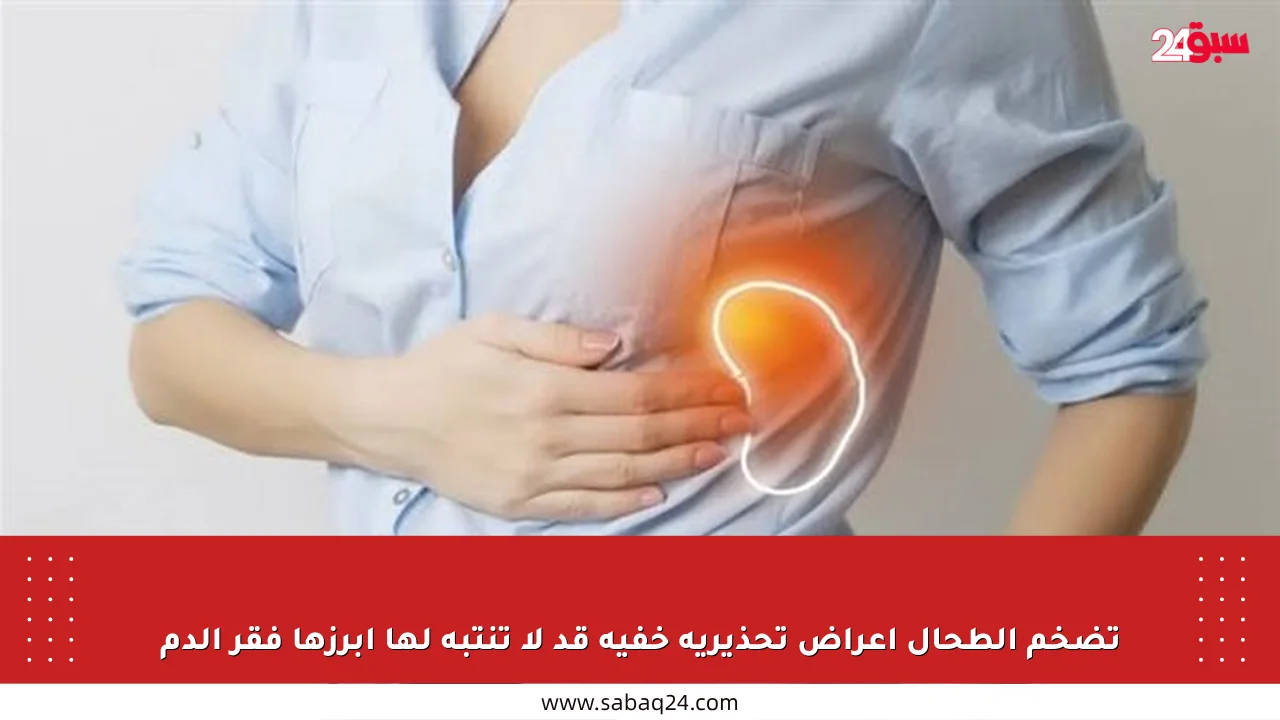 تضخم الطحال أعراض تحذيرية خفية قد لا تنتبه لها أبرزها فقر الدم